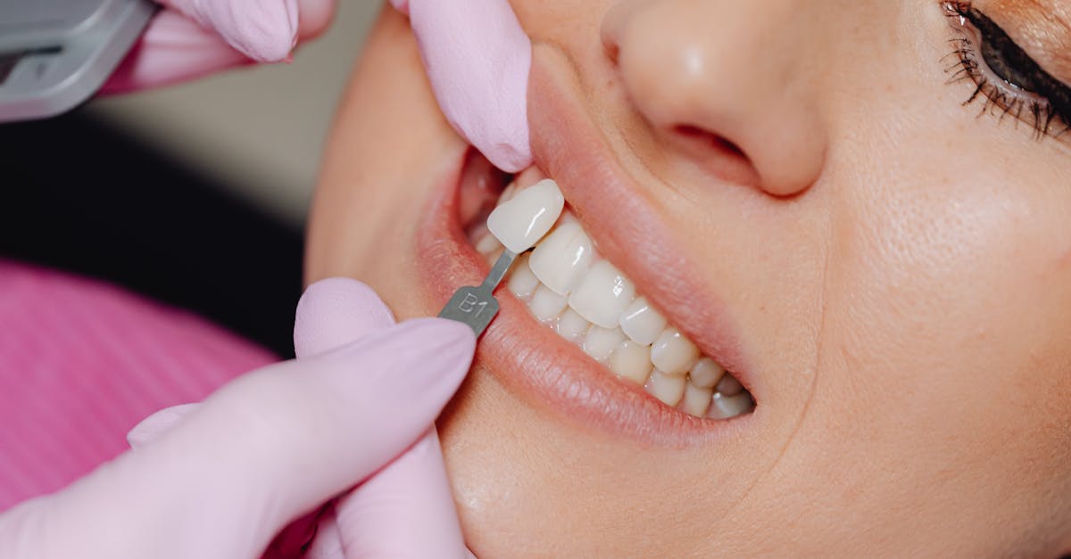 How much does it cost for a full set of dental implants in Turkey?