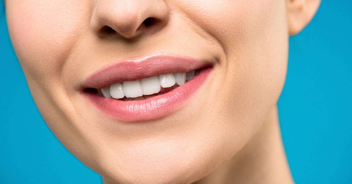 How much is a full set of dental implants in the UK?