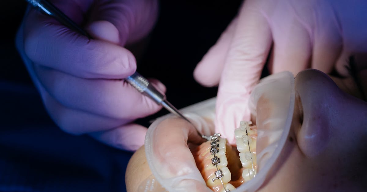 Who is not suitable for dental implants?